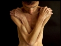 anorexia-bryan-bixler-2